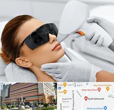 مرکز لیزر مو در سهروردی