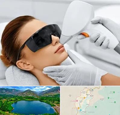 مرکز لیزر مو در رودبار