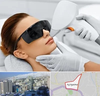مرکز لیزر مو در محمودیه