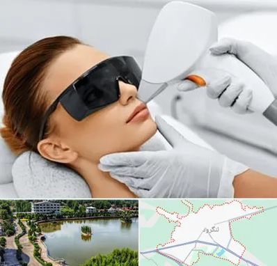 مرکز لیزر مو در لنگرود