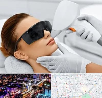 مرکز لیزر مو در منظریه رشت