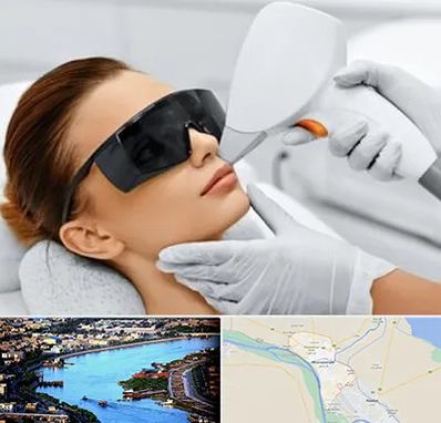 مرکز لیزر مو در خرمشهر