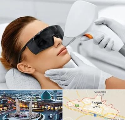 مرکز لیزر مو در زنجان
