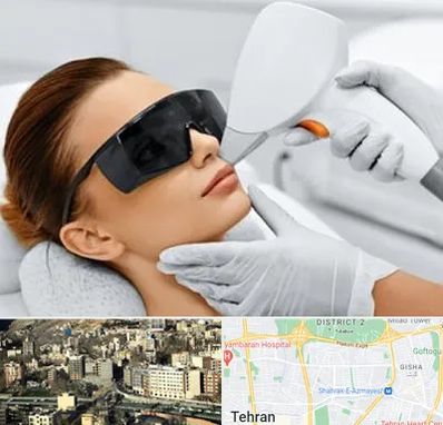 مرکز لیزر مو در مرزداران