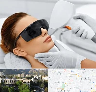 مرکز لیزر مو در دیباجی