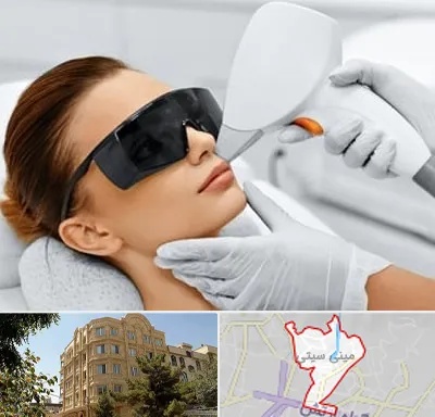 مرکز لیزر مو در مینی سیتی