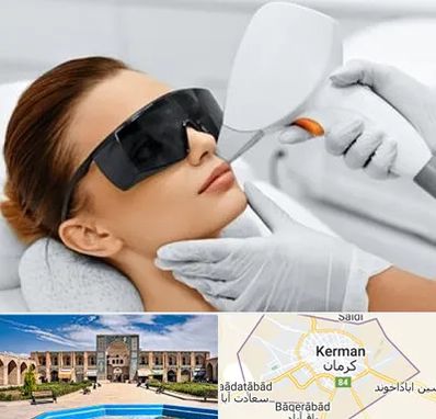 مرکز لیزر مو در کرمان