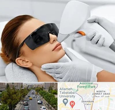 مرکز لیزر مو در شهران
