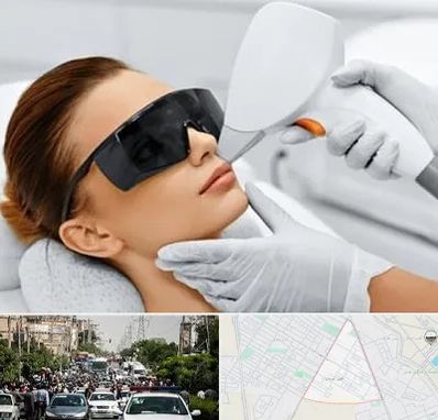 مرکز لیزر مو در سیدی مشهد