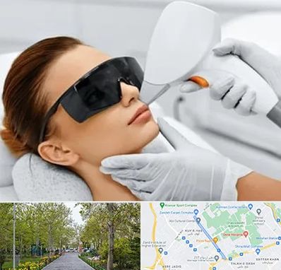 مرکز لیزر مو در قدوسی غربی شیراز