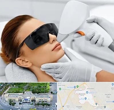 مرکز لیزر مو در نسیم شهر