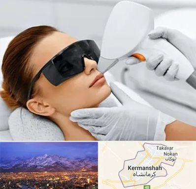 مرکز لیزر مو در کرمانشاه