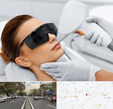 مرکز لیزر مو در دولت