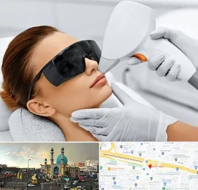 مرکز لیزر مو در رسالت