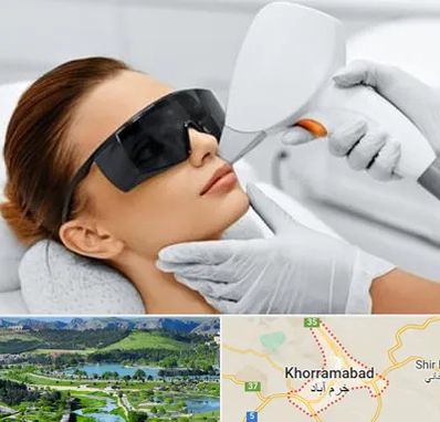 مرکز لیزر مو در خرم آباد