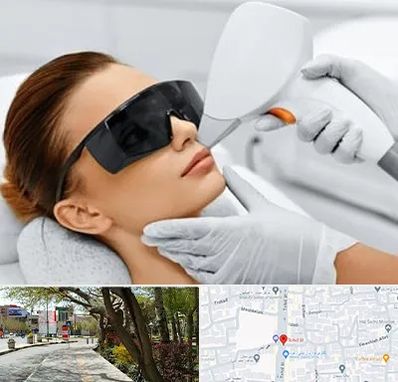 مرکز لیزر مو در خیابان توحید اصفهان