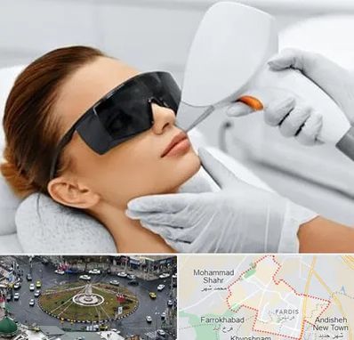 مرکز لیزر مو در فردیس کرج