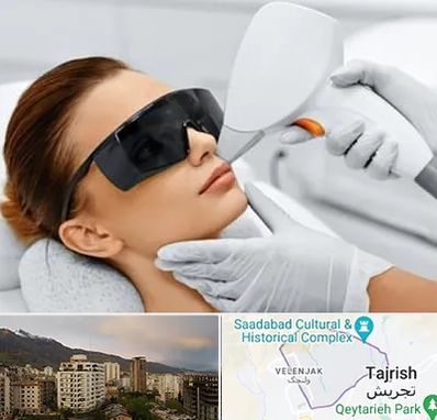 مرکز لیزر مو در زعفرانیه