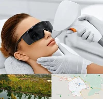 مرکز لیزر مو در بهبهان