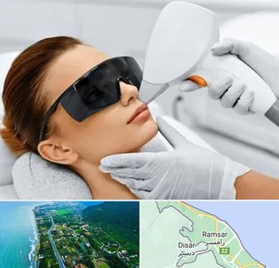 مرکز لیزر مو در رامسر