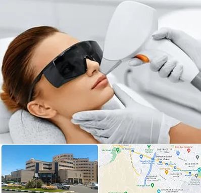 مرکز لیزر مو در صیاد شیرازی مشهد