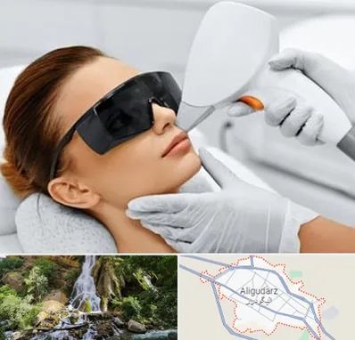 مرکز لیزر مو در الیگودرز