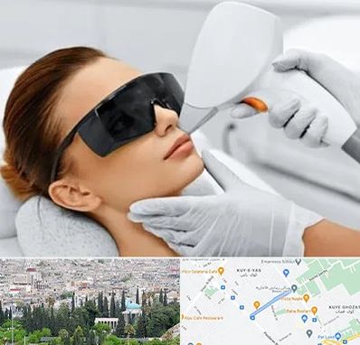 مرکز لیزر مو در محلاتی شیراز