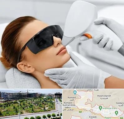 مرکز لیزر مو در پردیس