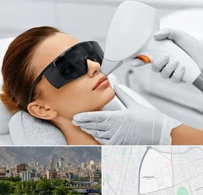 مرکز لیزر مو در جمشیدیه