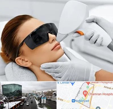 مرکز لیزر مو در اقدسیه