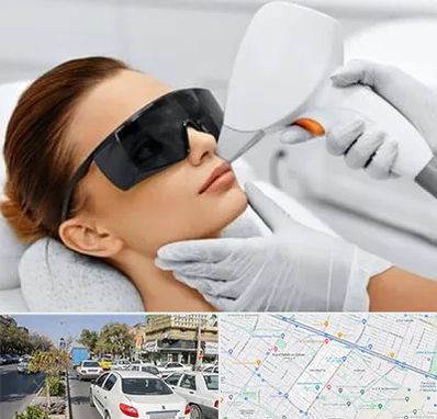 مرکز لیزر مو در مفتح مشهد