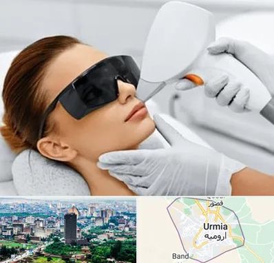 مرکز لیزر مو در ارومیه