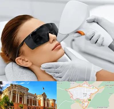 مرکز لیزر مو در خوی