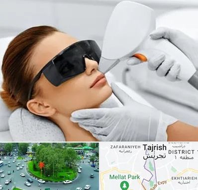 مرکز لیزر مو در تجریش