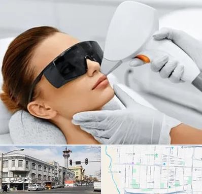 مرکز لیزر مو در 17شهریور