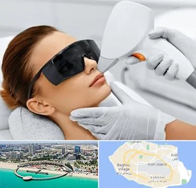 مرکز لیزر مو در کیش