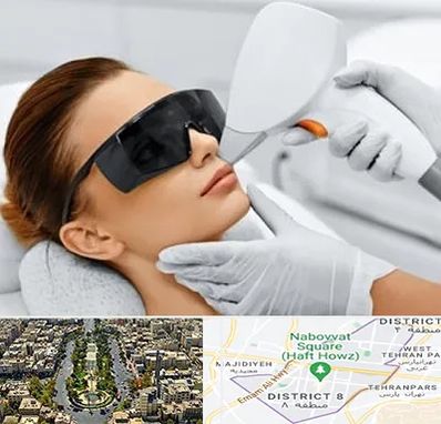 مرکز لیزر مو در نارمک