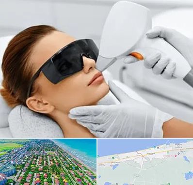 مرکز لیزر مو در فریدونکنار