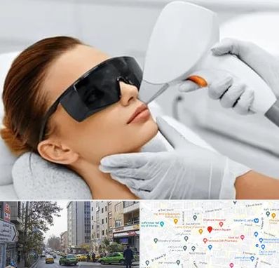 مرکز لیزر مو در فاطمی