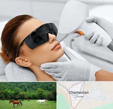 مرکز لیزر مو در چمستان