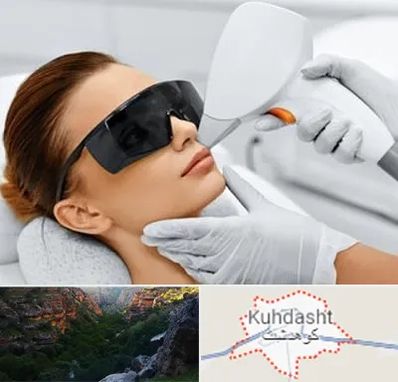 مرکز لیزر مو در کوهدشت