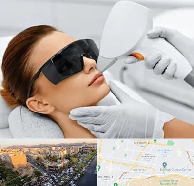 مرکز لیزر مو در تهرانپارس