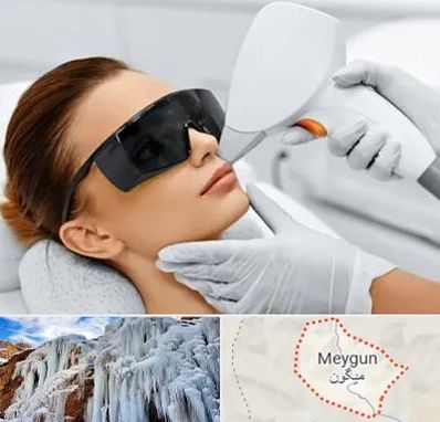 مرکز لیزر مو در میگون