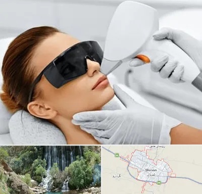 مرکز لیزر مو در شیروان