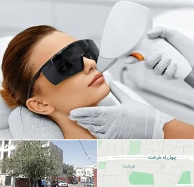 مرکز لیزر مو در طرشت