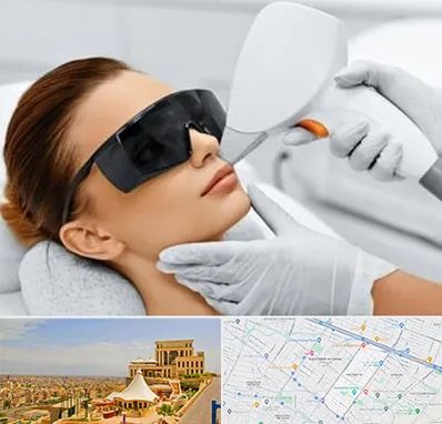 مرکز لیزر مو در هاشمیه مشهد