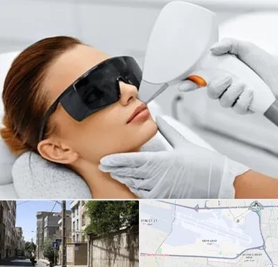 مرکز لیزر مو در مهرآباد