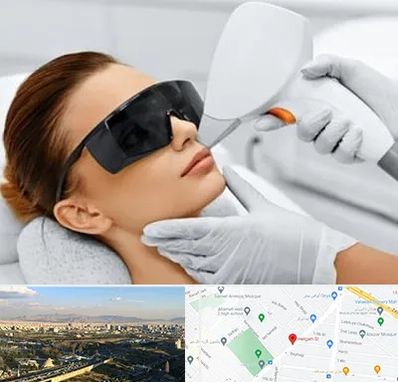 مرکز لیزر مو در هنگام