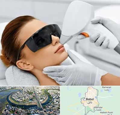 مرکز لیزر مو در بابل
