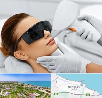 مرکز لیزر مو در نوشهر